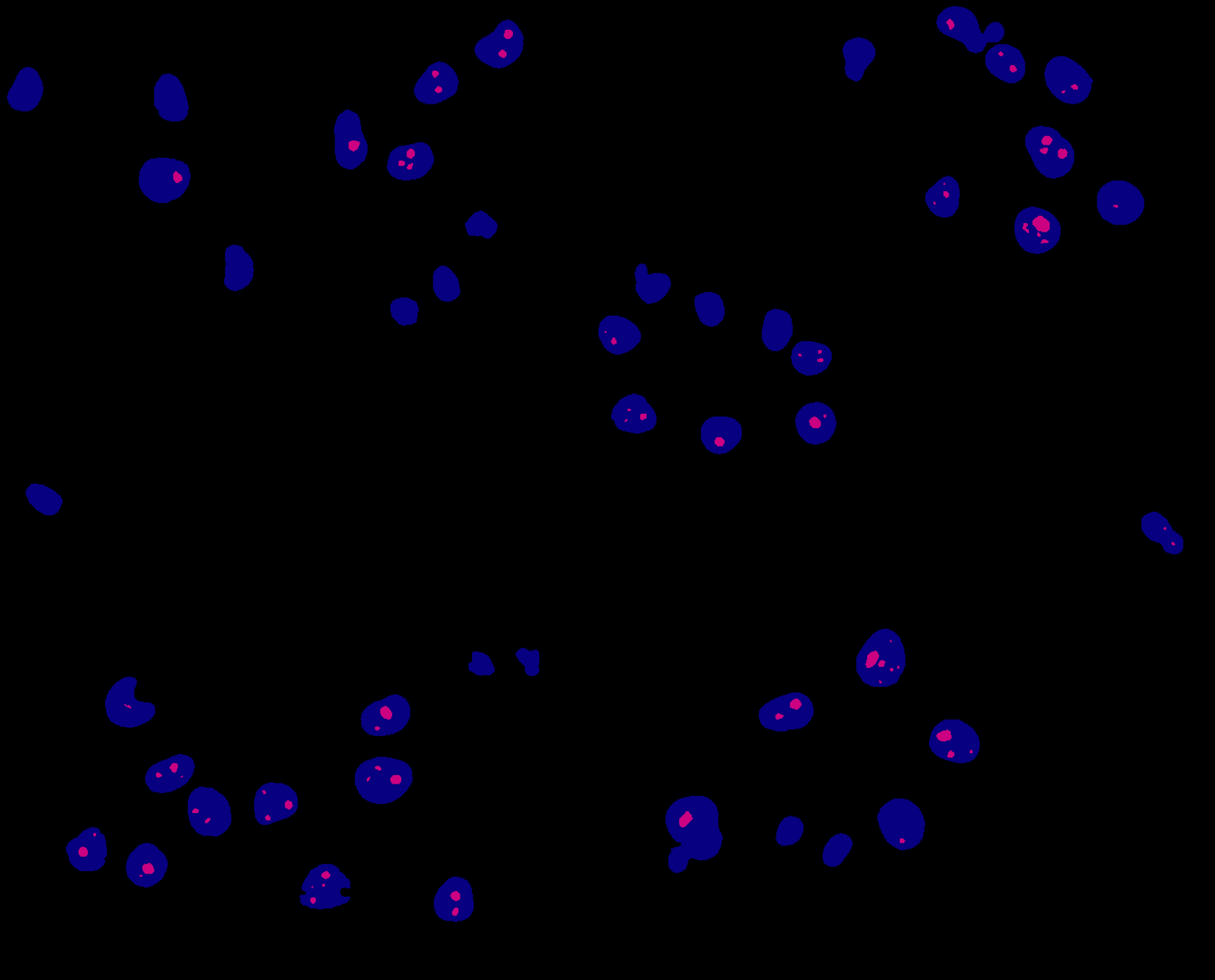 Combined mask for nuclei and nucleoli. 